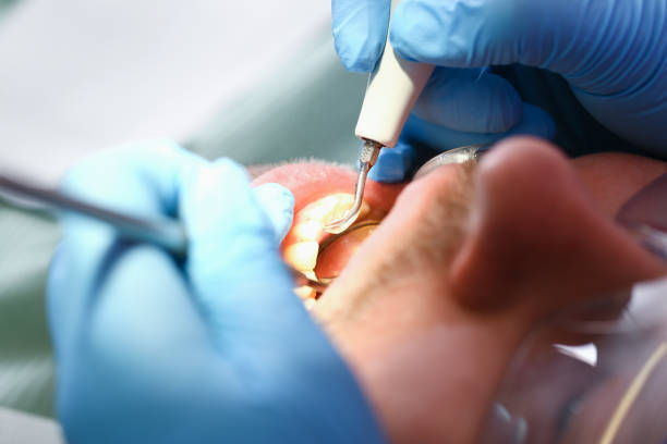 Best Emergency Treatment for Toothache in Nissequogue, NY